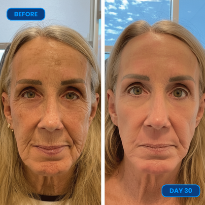 Purelia™ Anti Aging Serum