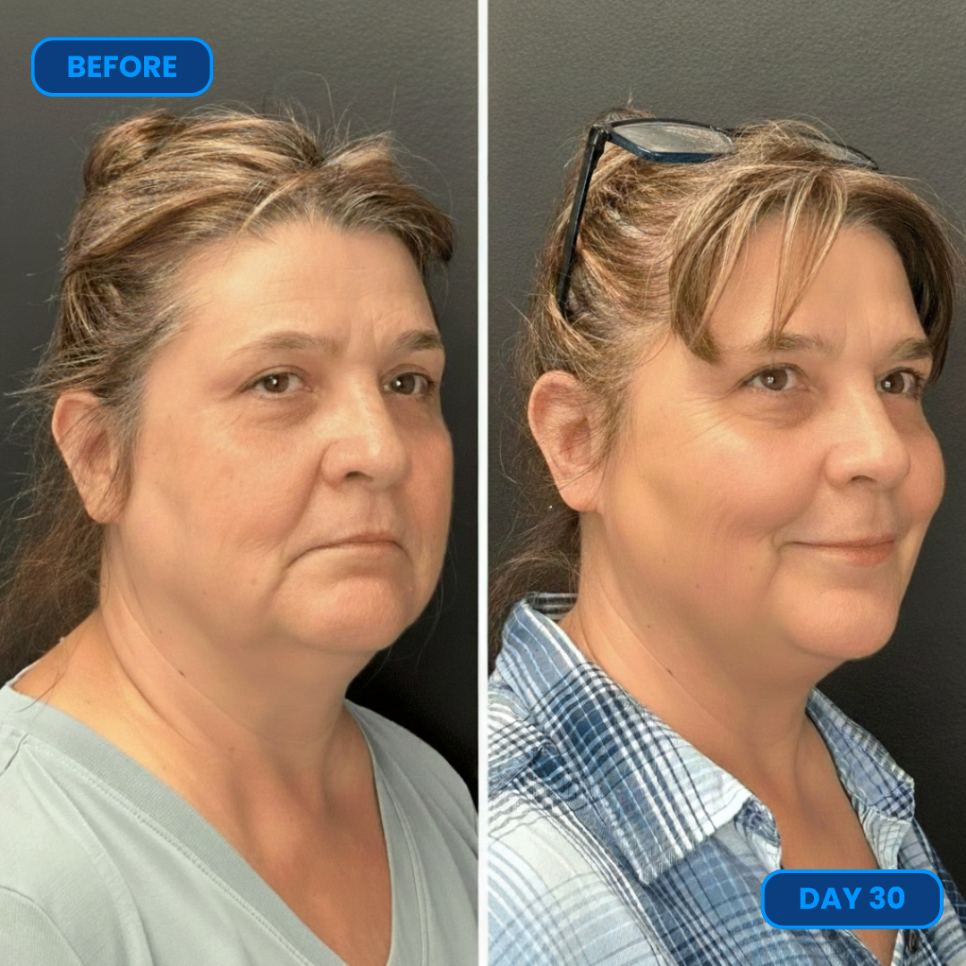 Purelia™ Anti Aging Serum