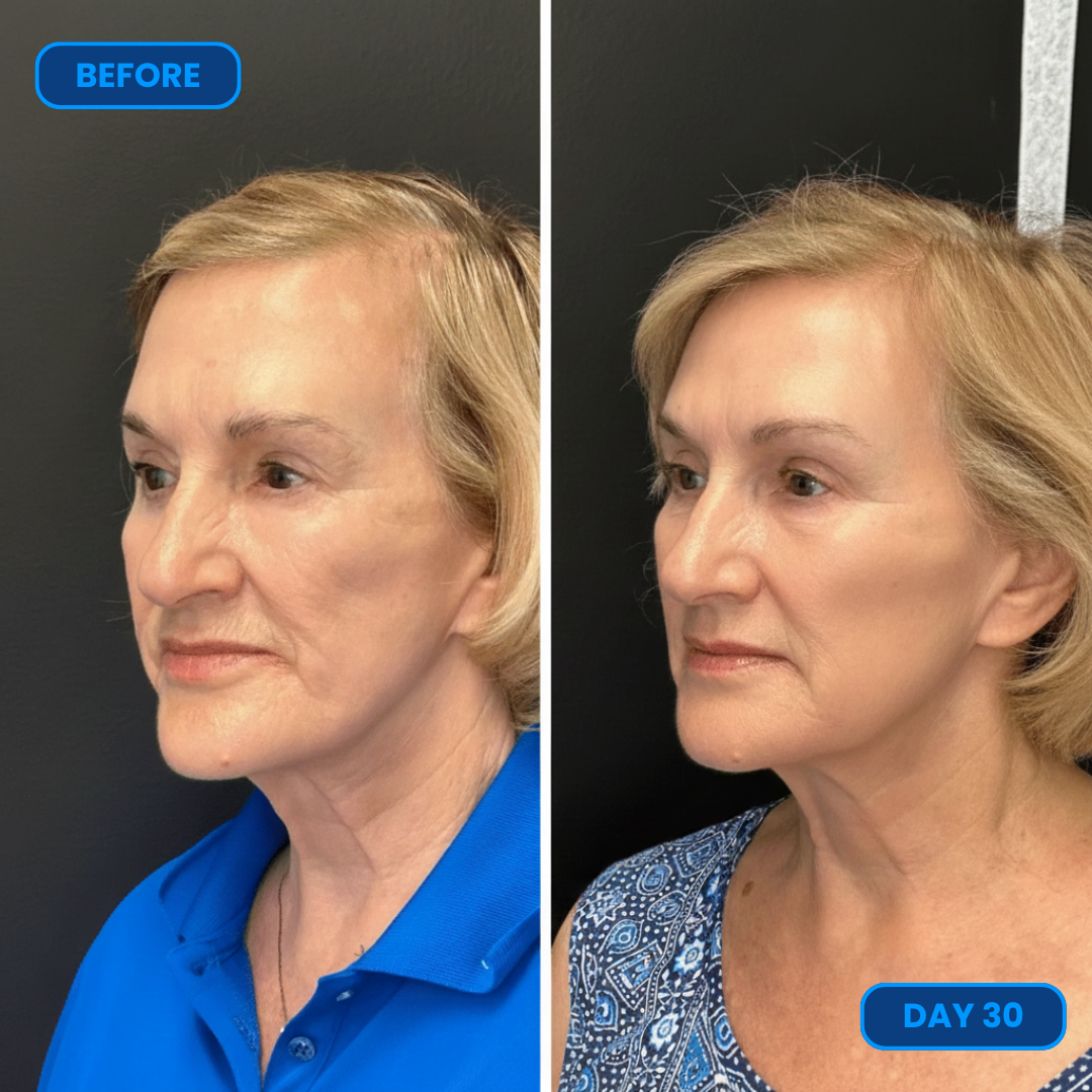 Purelia™ Anti Aging Serum